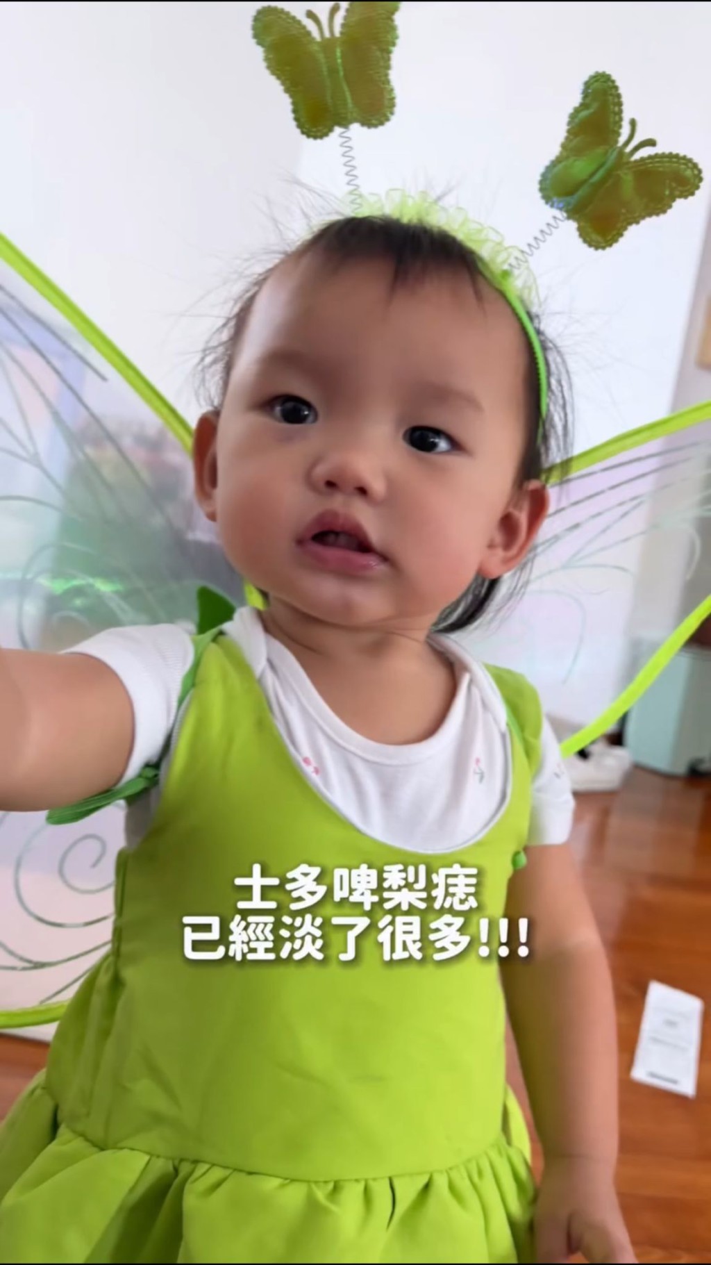 梁諾妍細女眼下的血管瘤已明顯淡退(圖片來源:IG@inez_leong) 梁諾妍細女眼下的血管瘤已明顯淡退(圖片來源:IG@inez_leong)
