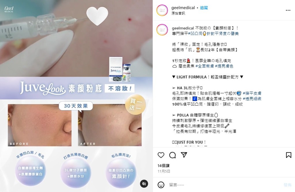 「GEEL Medical」社交專頁仍有宣傳「膠原蛋白美容針」等療程。geelmedical instagram截圖