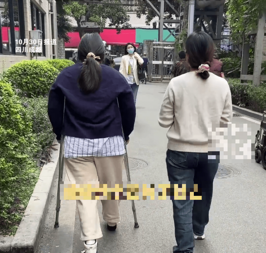 骨溶症女生步行需要使用雙柺杖。 紅星新聞 骨溶症女生步行需要使用雙柺杖。 紅星新聞