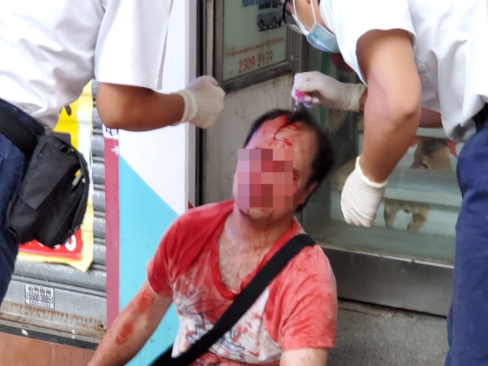一名男子血流滿面。