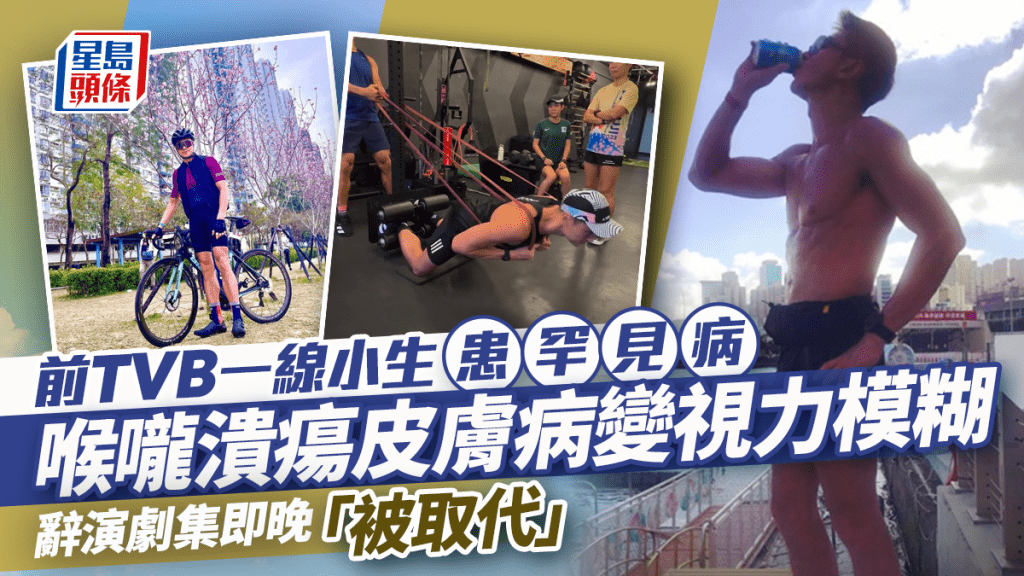	49歲前TVB一線小生自爆患罕見病  喉嚨潰瘍皮膚病變視力模糊  辭演劇集即晚「被取代」