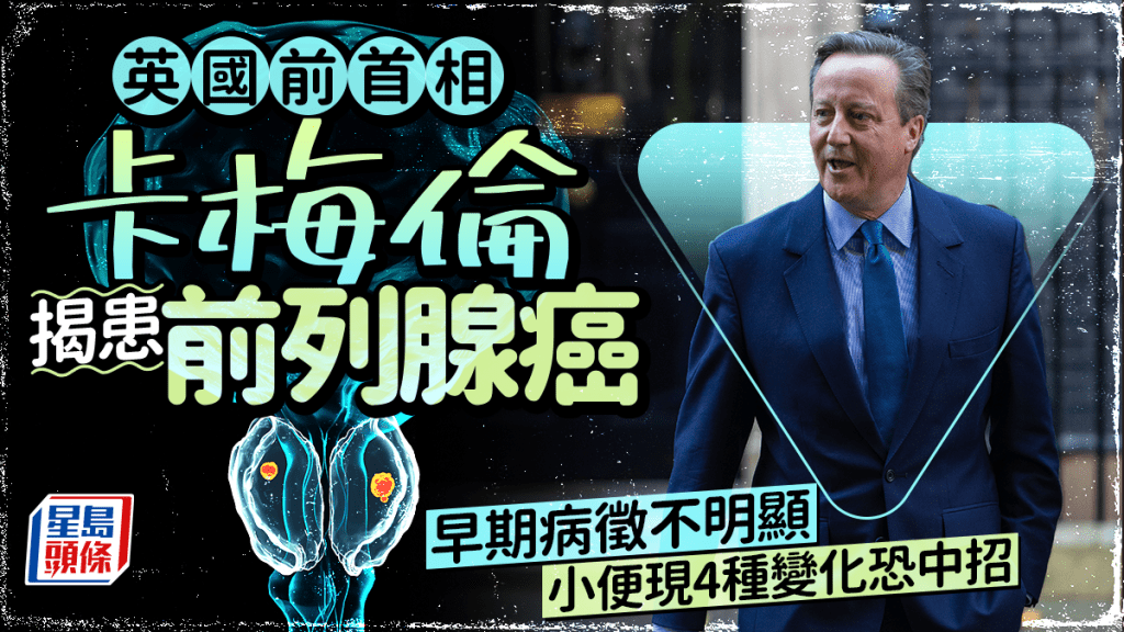 英國前首相卡梅倫揭患前列腺癌  早期病徵不明顯 小便現4種變化恐中招