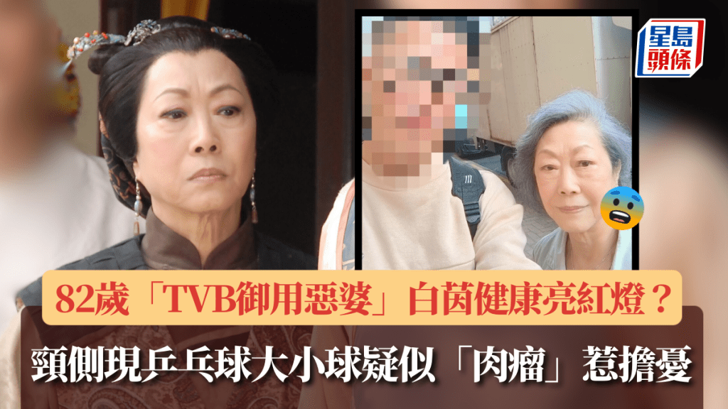 82歲「TVB御用惡婆」白茵健康亮紅燈？  近照頸側離奇現乒乓球大小疑似「肉瘤」惹擔憂