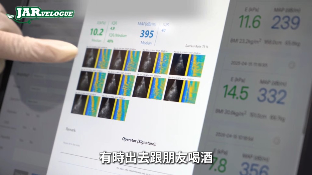 周奕瑋稱自知平時吃東西太放肆,因此安排自己做肝檢測。 周奕瑋稱自知平時吃東西太放肆,因此安排自己做肝檢測。