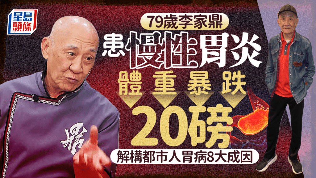 79歲李家鼎患慢性胃炎體重暴跌20磅消瘦身形惹關注  醫生解構都市人胃病8大成因
