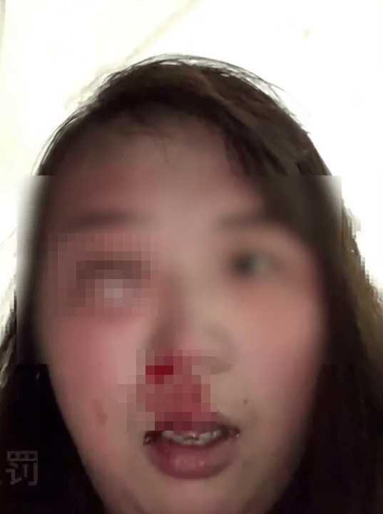 艾女發布被家暴的照片。 艾女發布被家暴的照片。