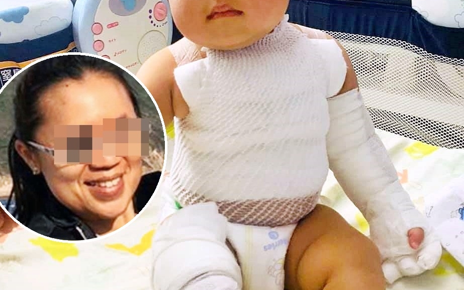 外傭(小圖)因熱湯放太近致小孩二級燒傷。 外傭僱主必看新聞訊息 公開群 FB圖片