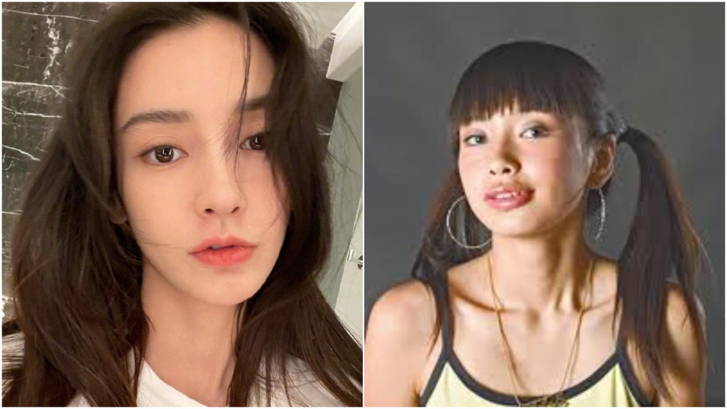 Angelababy告醫院擅用爆牙相作宣傳獲賠近4萬 曾做面部鑑定證冇整容