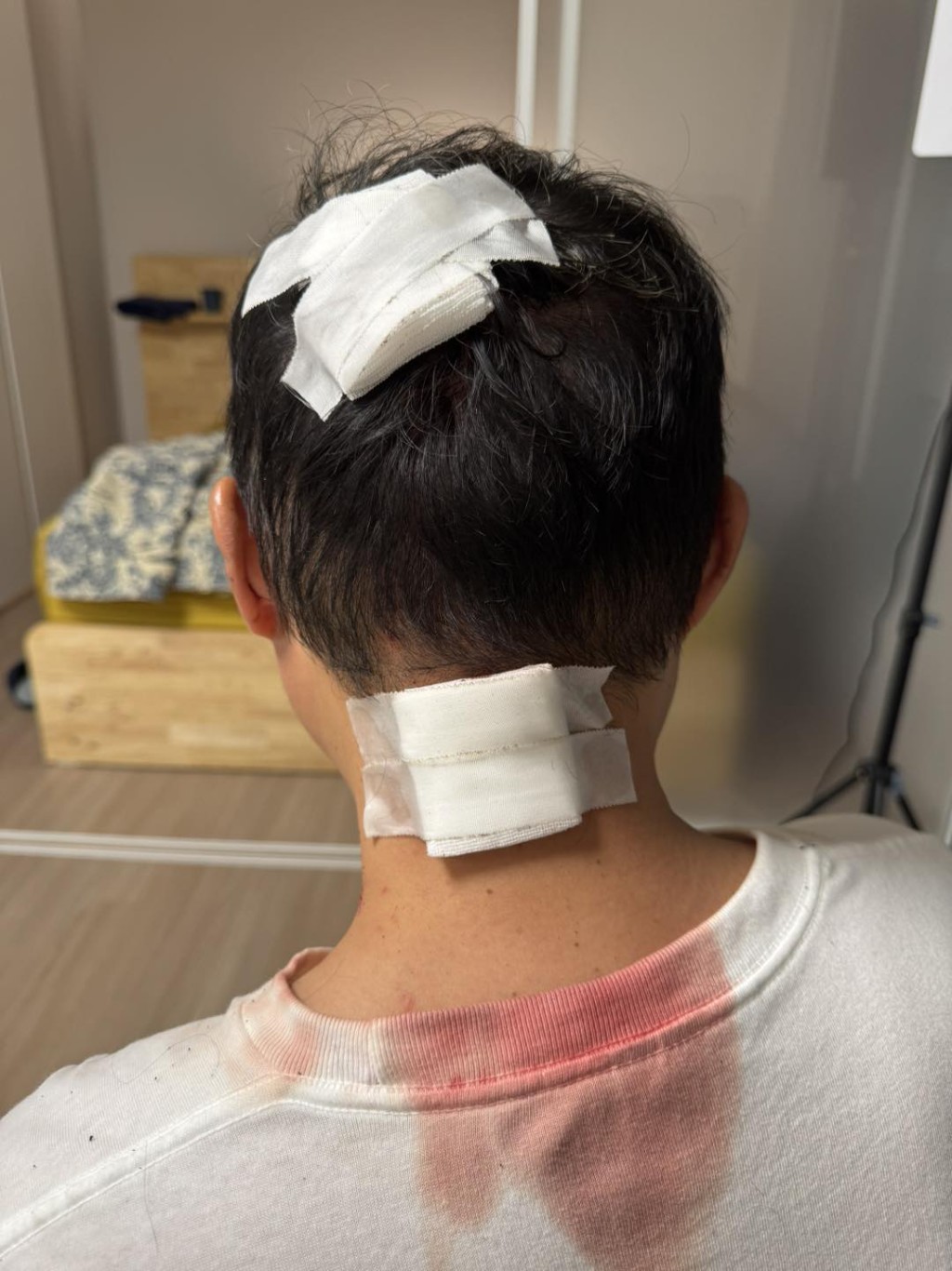 二人身上有多處傷勢，其中後腦及頸部較為嚴重。「GLMX.store」fb圖片