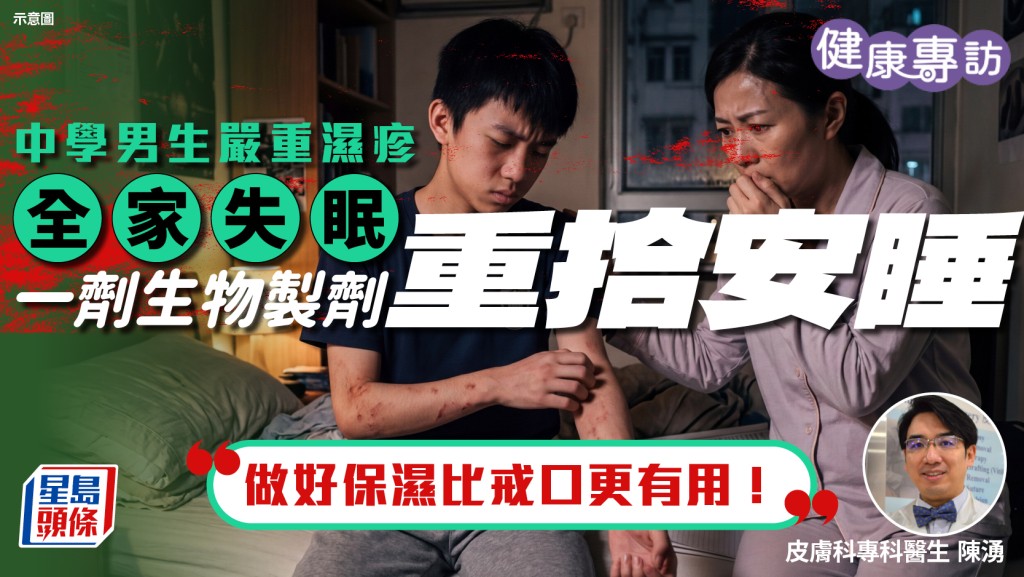 中學男生嚴重濕疹半夜痕醒全家失眠 一劑生物製劑重拾安睡 醫生籲做好保濕比戒口更有用！