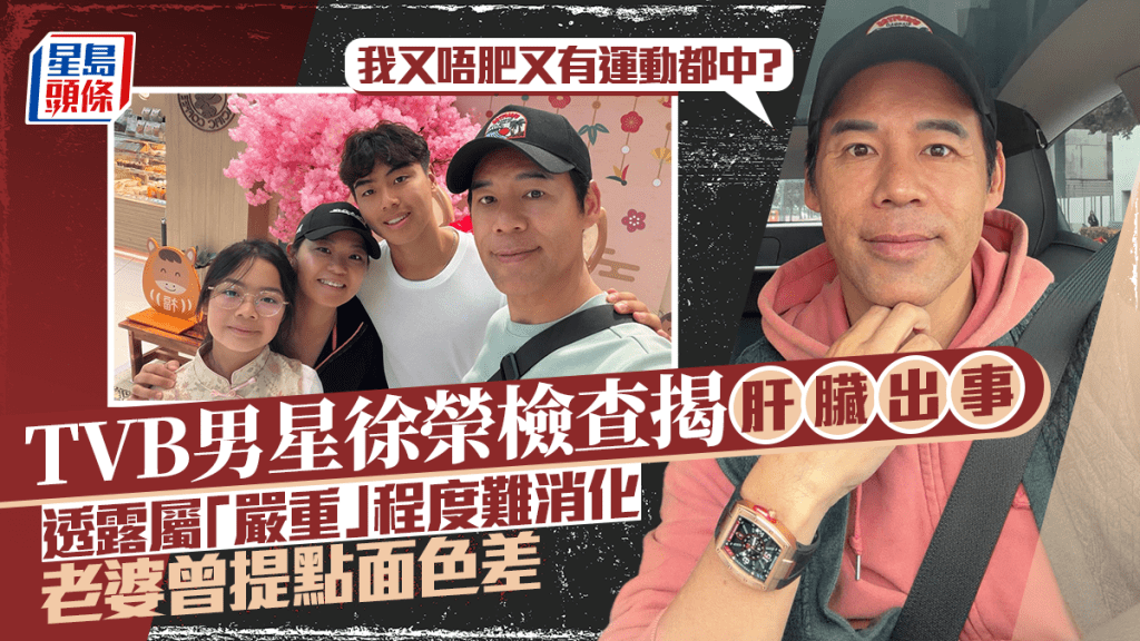 TVB男星徐榮肝臟出事屬「嚴重」程度  老婆曾提點面色差：我又唔肥又有運動都中？