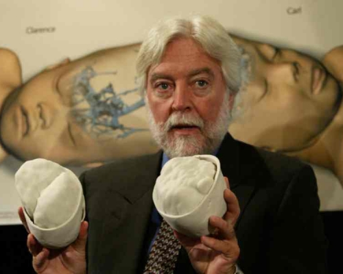 名醫James曾多次進行高難度的連體嬰分割手術揚名全球。fb