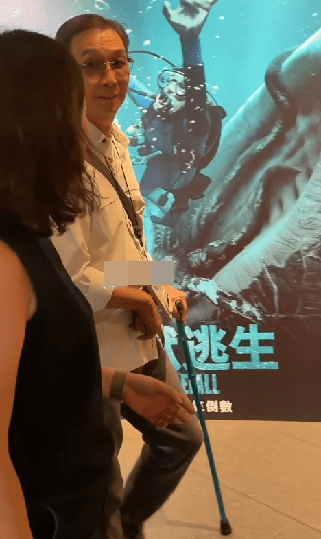 劉松仁的右手前臂依然是吊起僵硬。