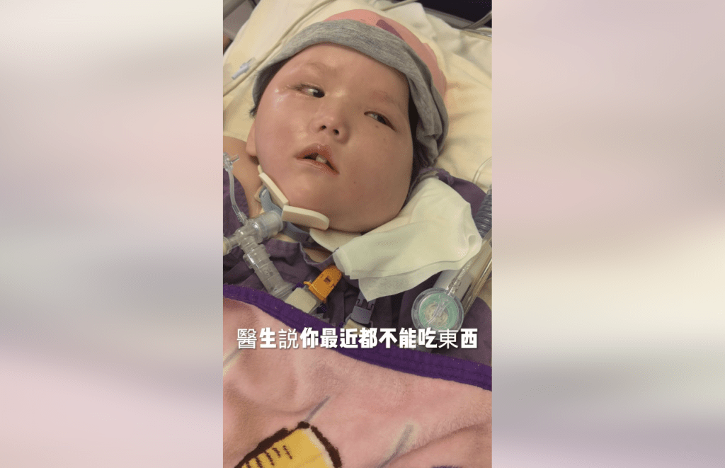 天瑜爸爸昨（29日）晩在社交網站上傳一段影片，指天瑜上週出現胃出血，已差不多一星期沒有吃奶。