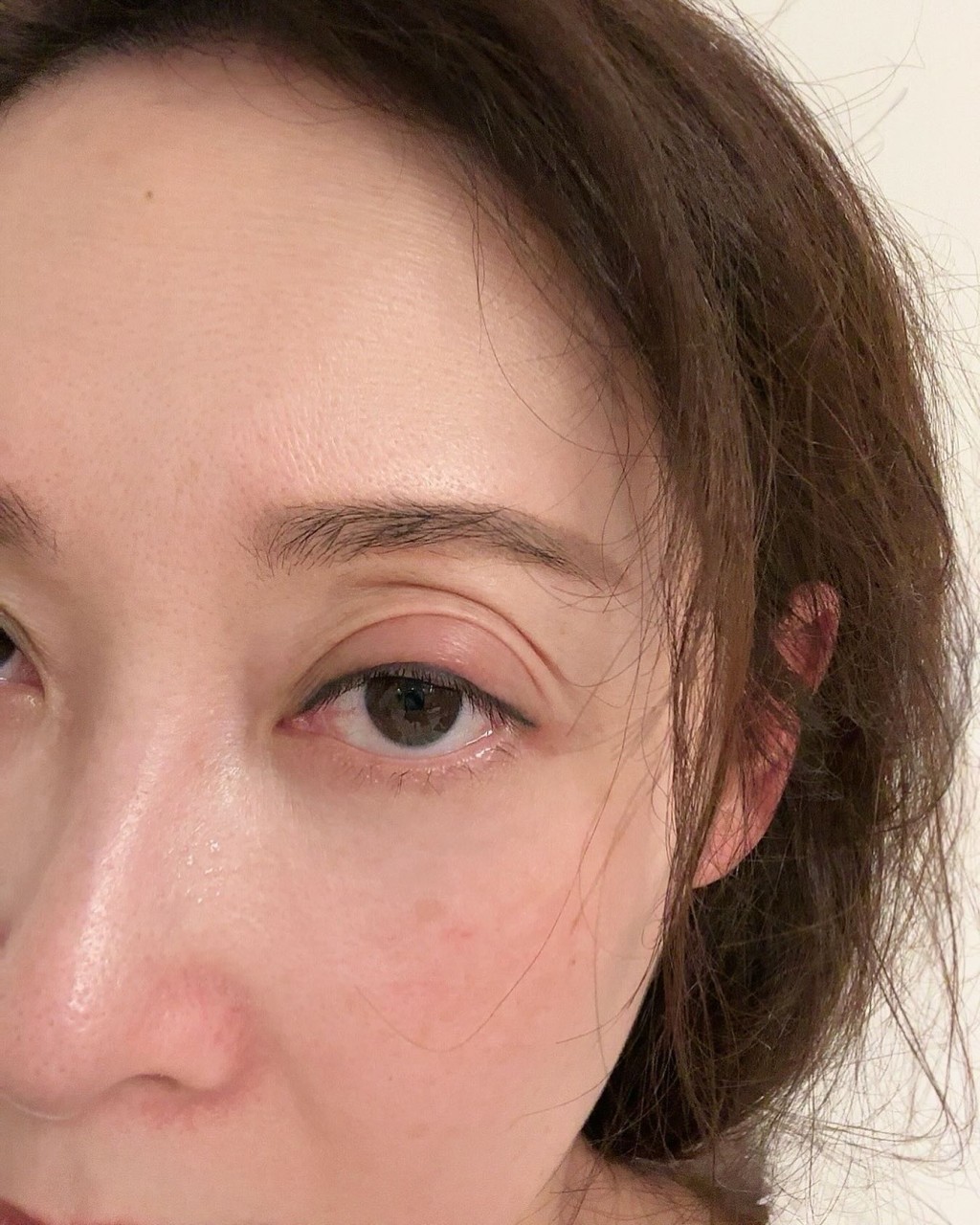 昨日（2日）杨卓娜在IG贴上一张眼部大特写相并称又生眼疮，她自嘲：「就嚟生到变眼疮专家！」