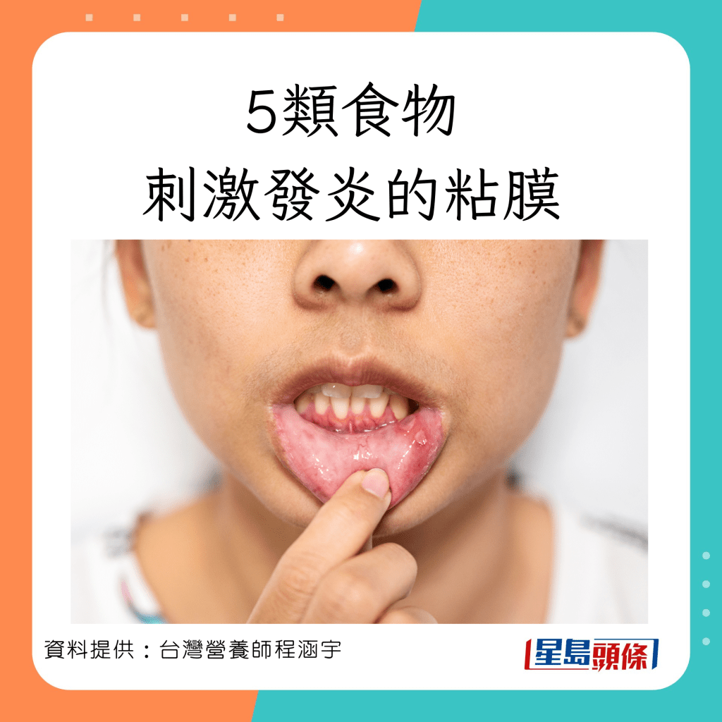 營養師程涵宇指要避免吃5類刺激發炎的粘膜的食物。
