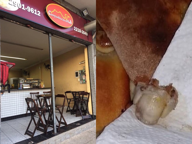 人類手指現肉餅。網圖