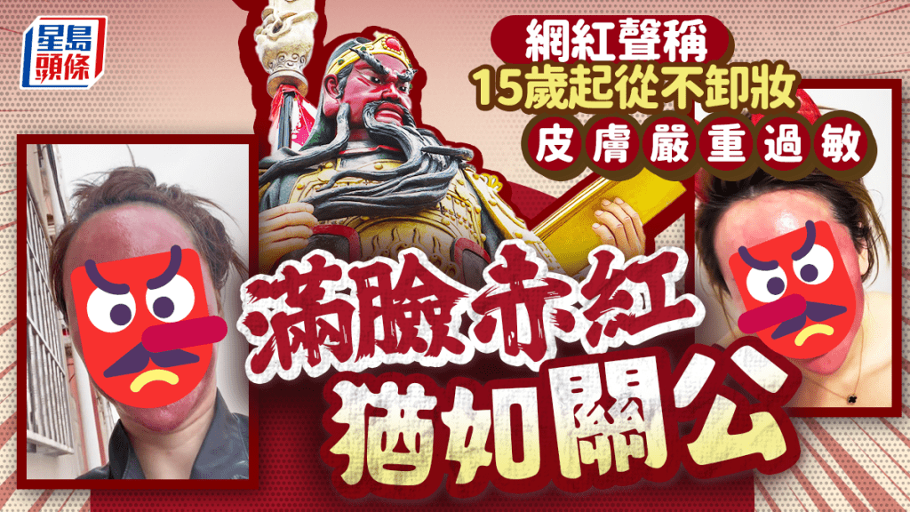 爛面網紅︱吉林女22年不卸妝 驚變「硬殼」女關公︱慎入