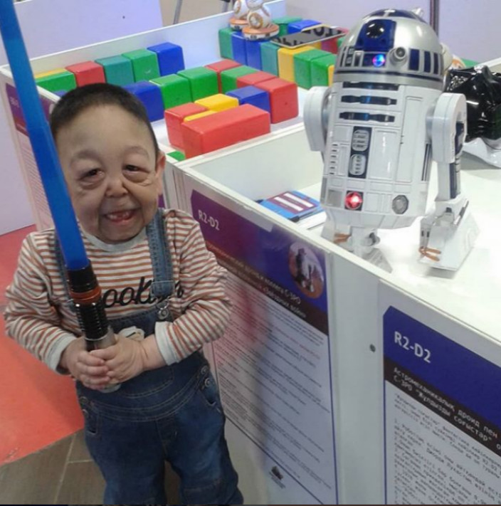 男童患罕见病,身体状态如80岁老人。网图