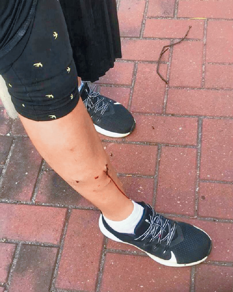 ■青衣流浪狗咬傷居民。