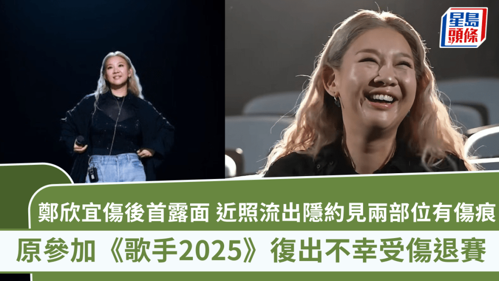 鄭欣宜受傷後首露面  原參加《歌手2025》復出不幸受傷退賽 近照流出隱約見兩部位有傷痕