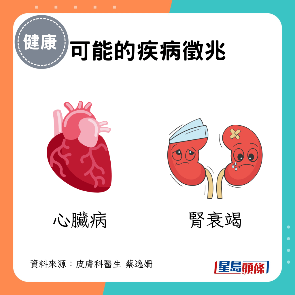 可能是心臟病、腎衰竭徵兆