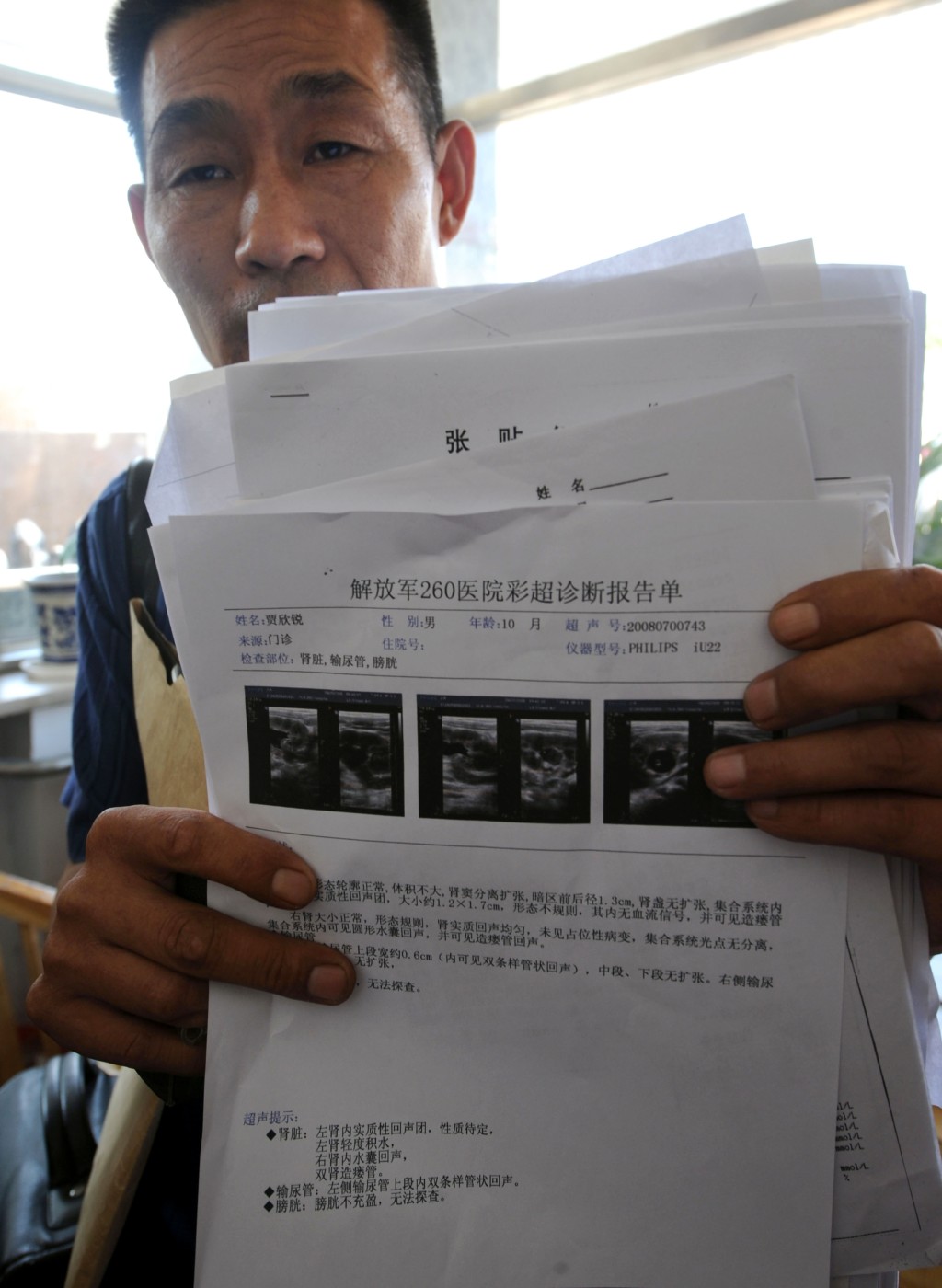 一名家長展示孩子在醫院做的腎臟、膀胱的病灶超聲波檢查報告。 新華社