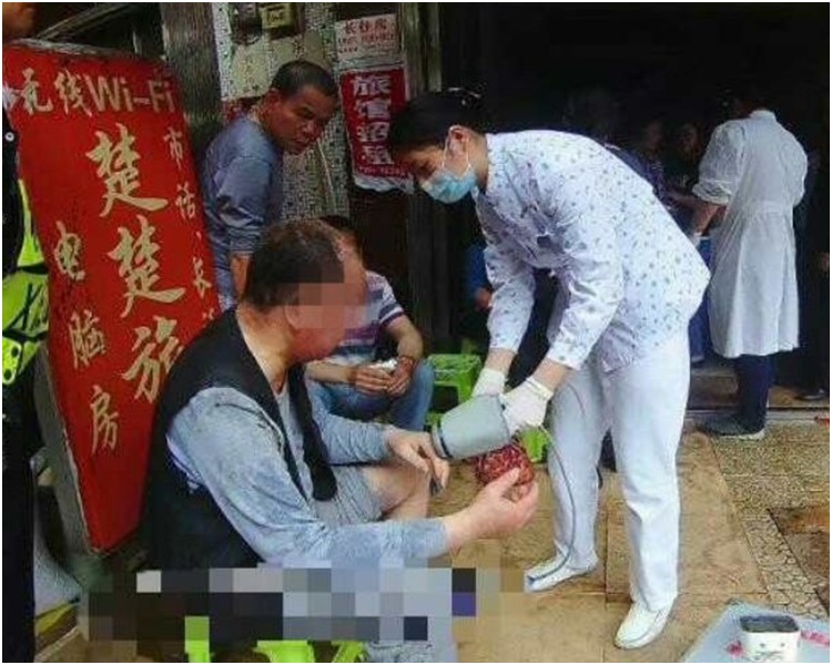 有人头发被烧焦,所幸伤势并不严重。