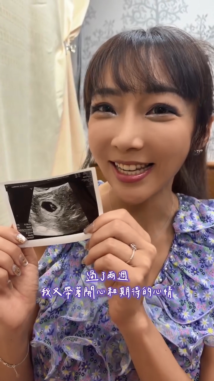 李宓首度自然受孕,心情既激動又驚訝。 李宓首度自然受孕,心情既激動又驚訝。