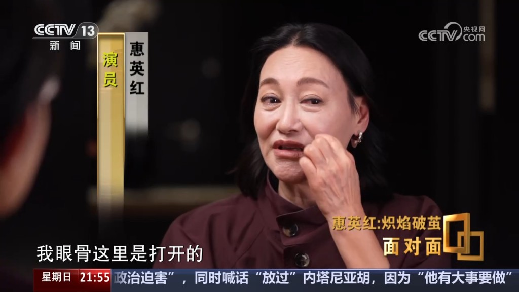 惠英紅憶述當時受傷情況。