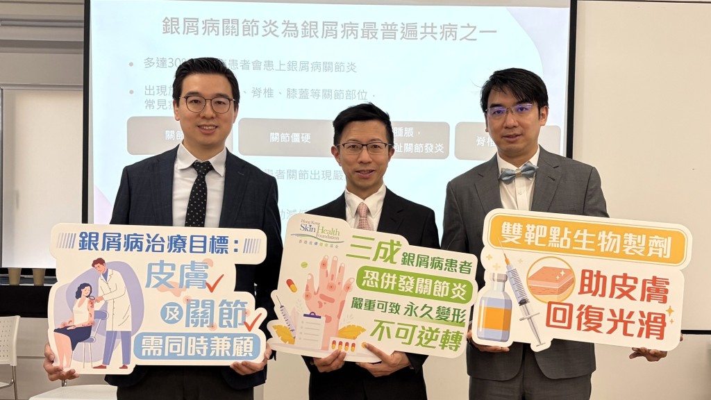 醫生提醒，多達三成銀屑病患者出現關節炎。