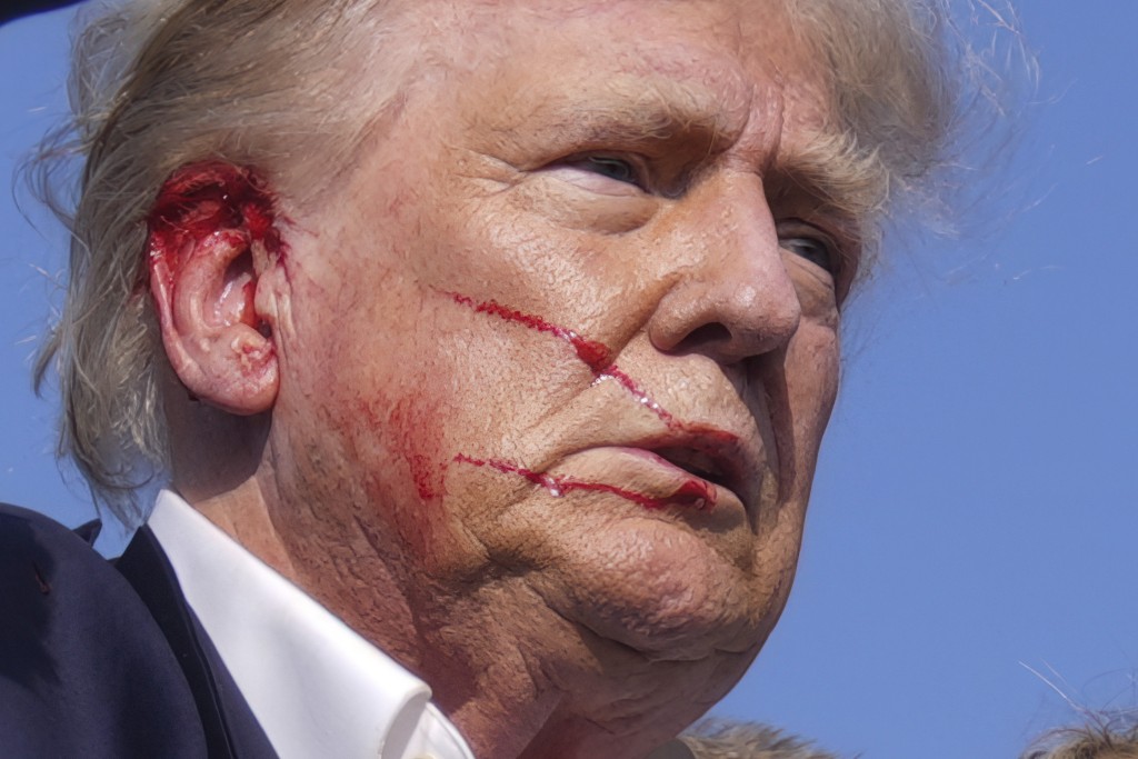 特朗普右耳中槍受傷情況良好，仍將出席共和黨大會。美聯社
