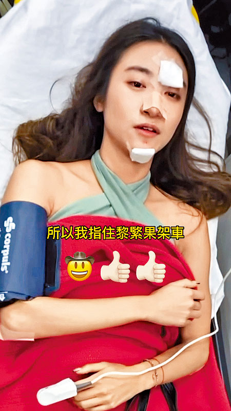 Jojo面部傷勢嚴重，事後在社交網報平安。