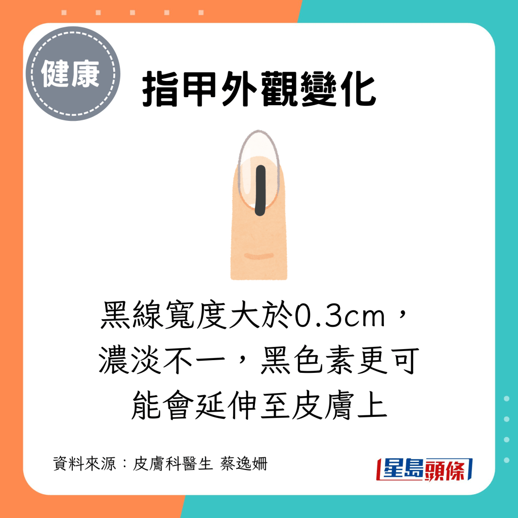 黑线宽度大于0.3cm，浓淡不一，黑色素更可能会延伸至皮肤上