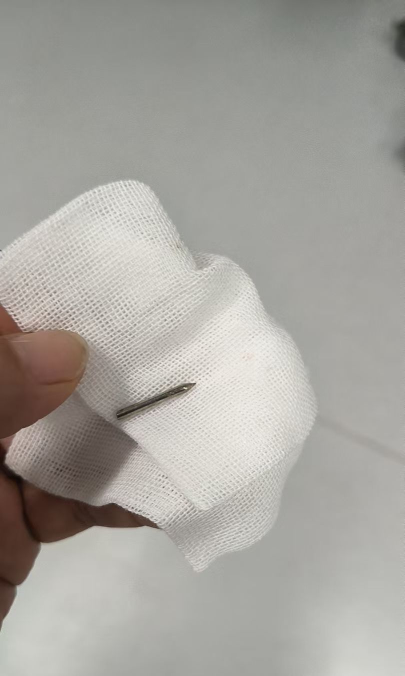 男孩誤吞圓規針，要由醫護團體透過手術取出。《現代快報》