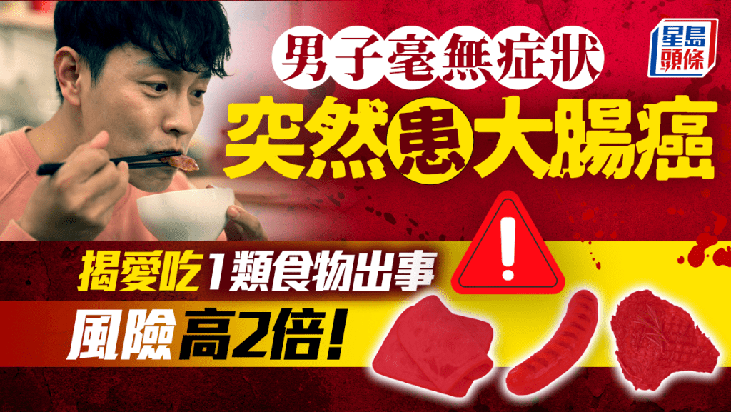 大腸癌成因｜男子毫無症狀突患大腸癌 揭1常見飲食習慣出事 增2倍風險