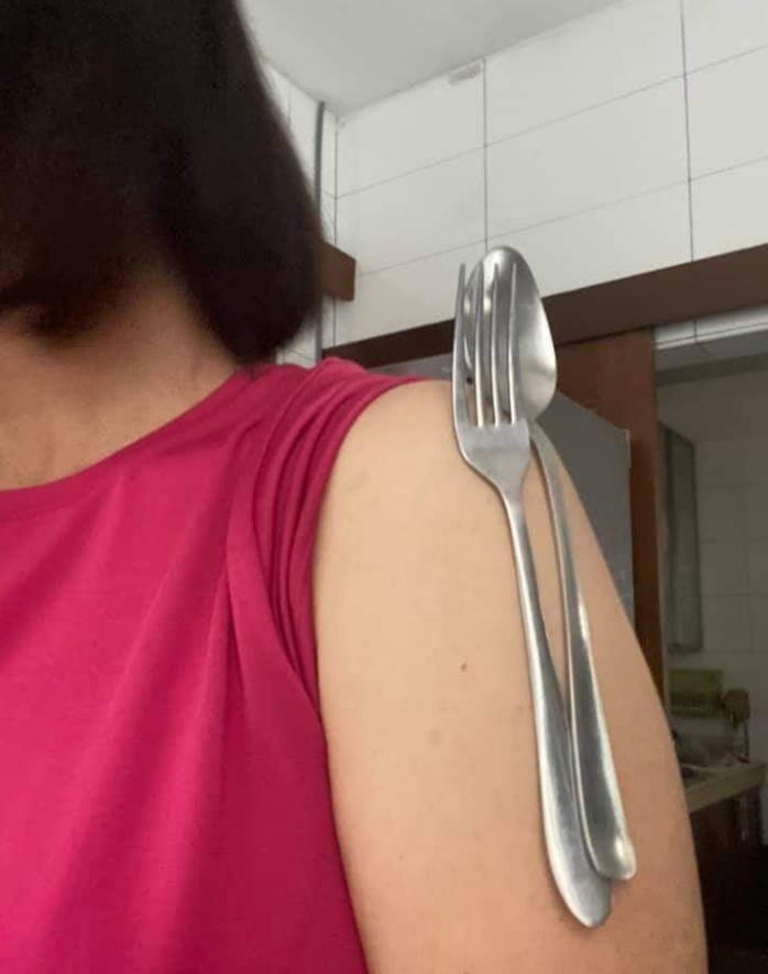 馬來西亞有人打疫苗後手臂可以吸附金屬。網上圖片