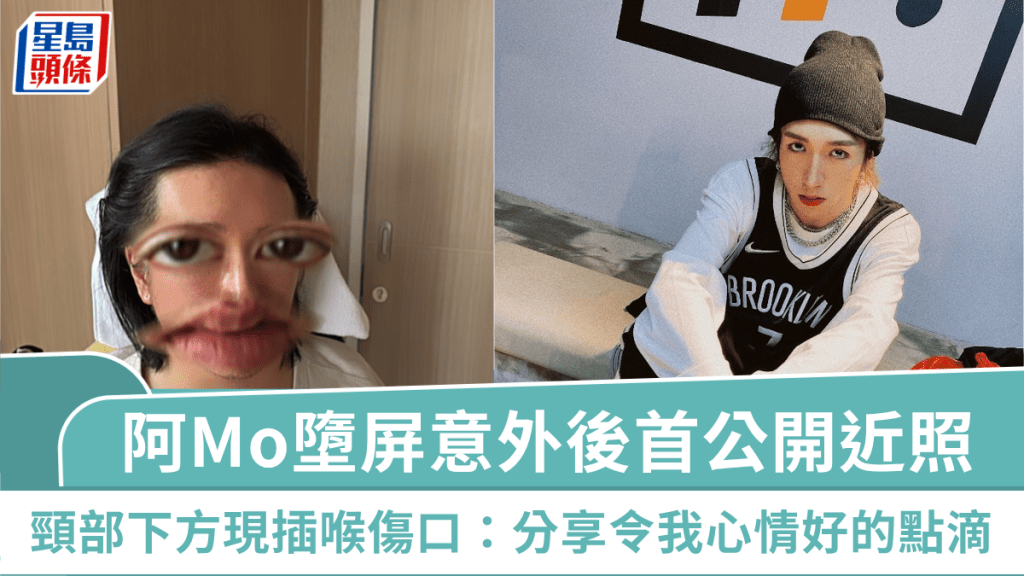 阿Mo李啟言MIRROR演唱會墮屏意外後首公開近照 頸部下方現插喉傷口