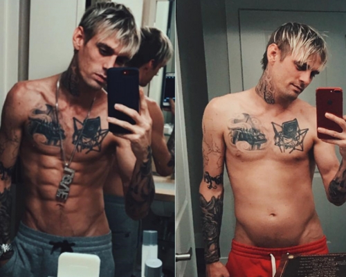 Aaron Carter成功增肥30磅,看來他已成功戒毒。