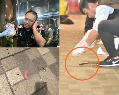 趙家賢耳朵送至醫院處理(左圖)。警方檢走證物(右圖)。