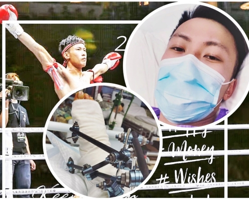 陳俊賢透露需接受手術並用支架困定腳部。網圖