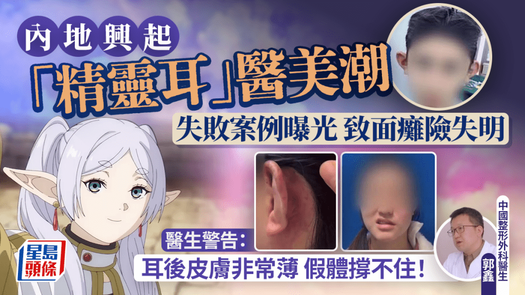內地興起「精靈耳」醫美潮 失敗案例曝光 致面癱險失明  醫生警告：耳後皮膚非常薄