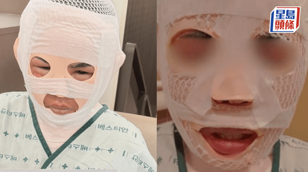 Facebook@NNutt AAomsin