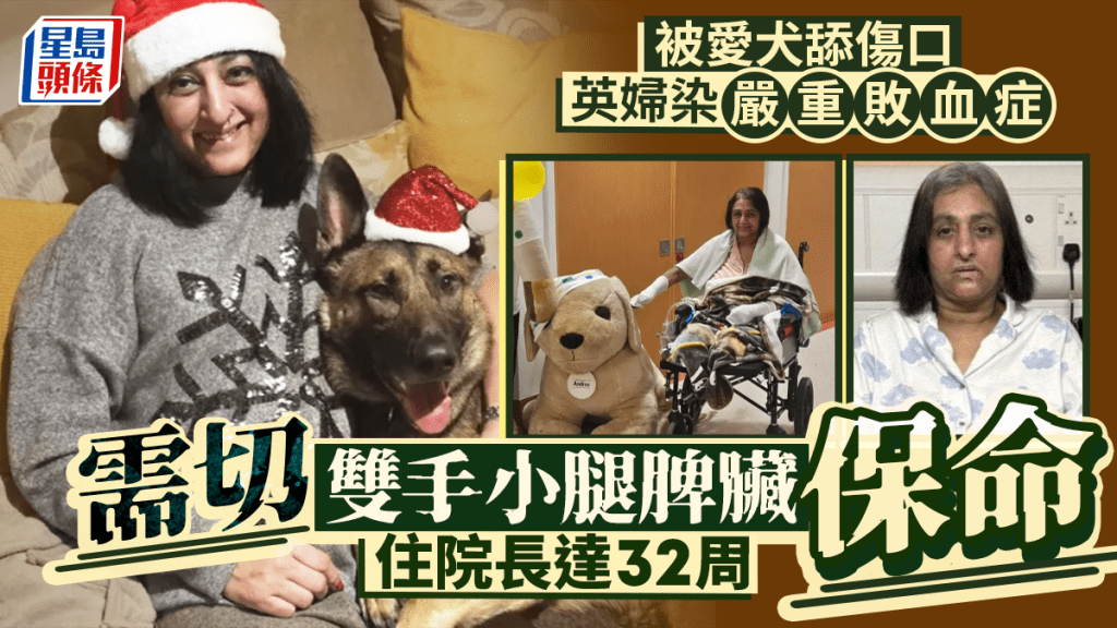 被爱犬舔一下引发败血症 英妇切双手小腿保命 生死经历曝光