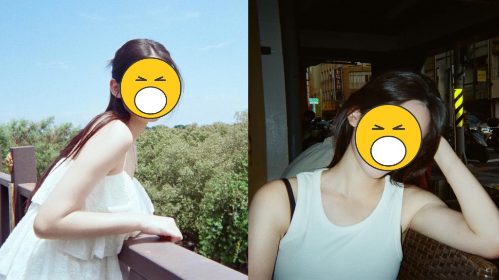 28歲「新一代少男殺手」做facial後爛面怒轟美容院卸責 公開與負責人對話:個人對護膚品有反應