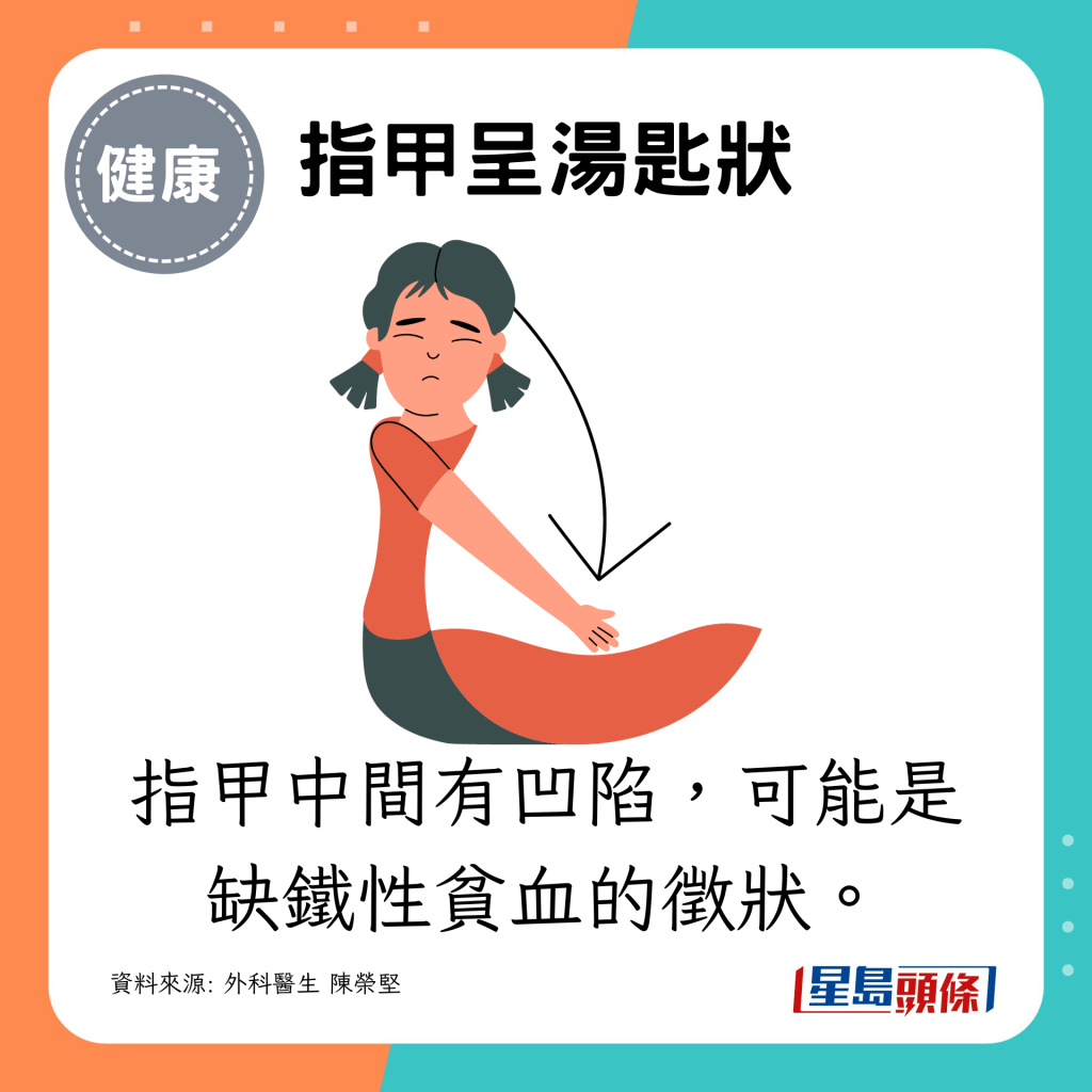 指甲中間有凹陷,可能是缺鐵性貧血的徵狀。