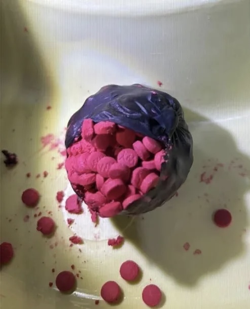 取出發現是粉紅色麻古(yaba)毒丸。 星暹日報微信公號 取出發現是粉紅色麻古(yaba)毒丸。 星暹日報微信公號