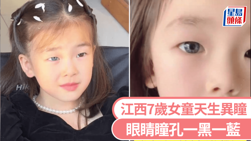 江西7歲女童天生異瞳，眼睛一黑一藍，母憂返學被欺凌，卻意外大受同築歡迎。