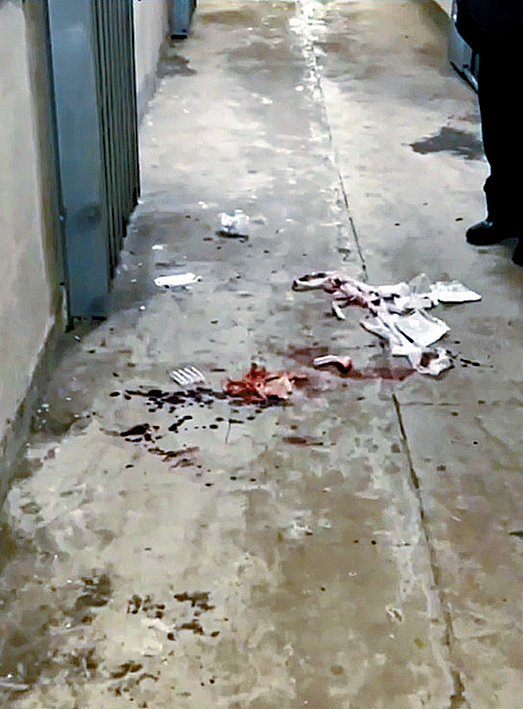 發生血案的走廊地上血跡斑斑。