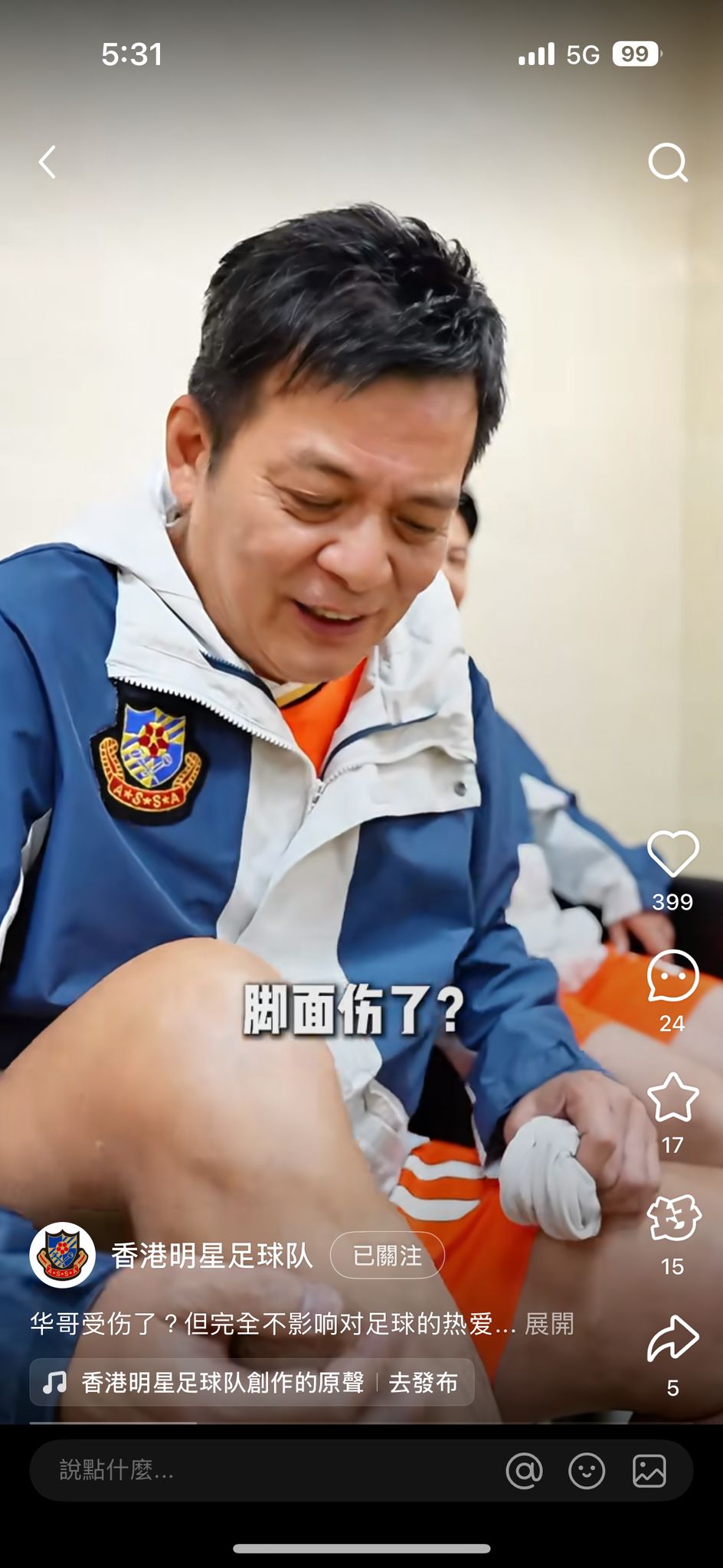 黃日華指自己腳底受傷。 黃日華指自己腳底受傷。